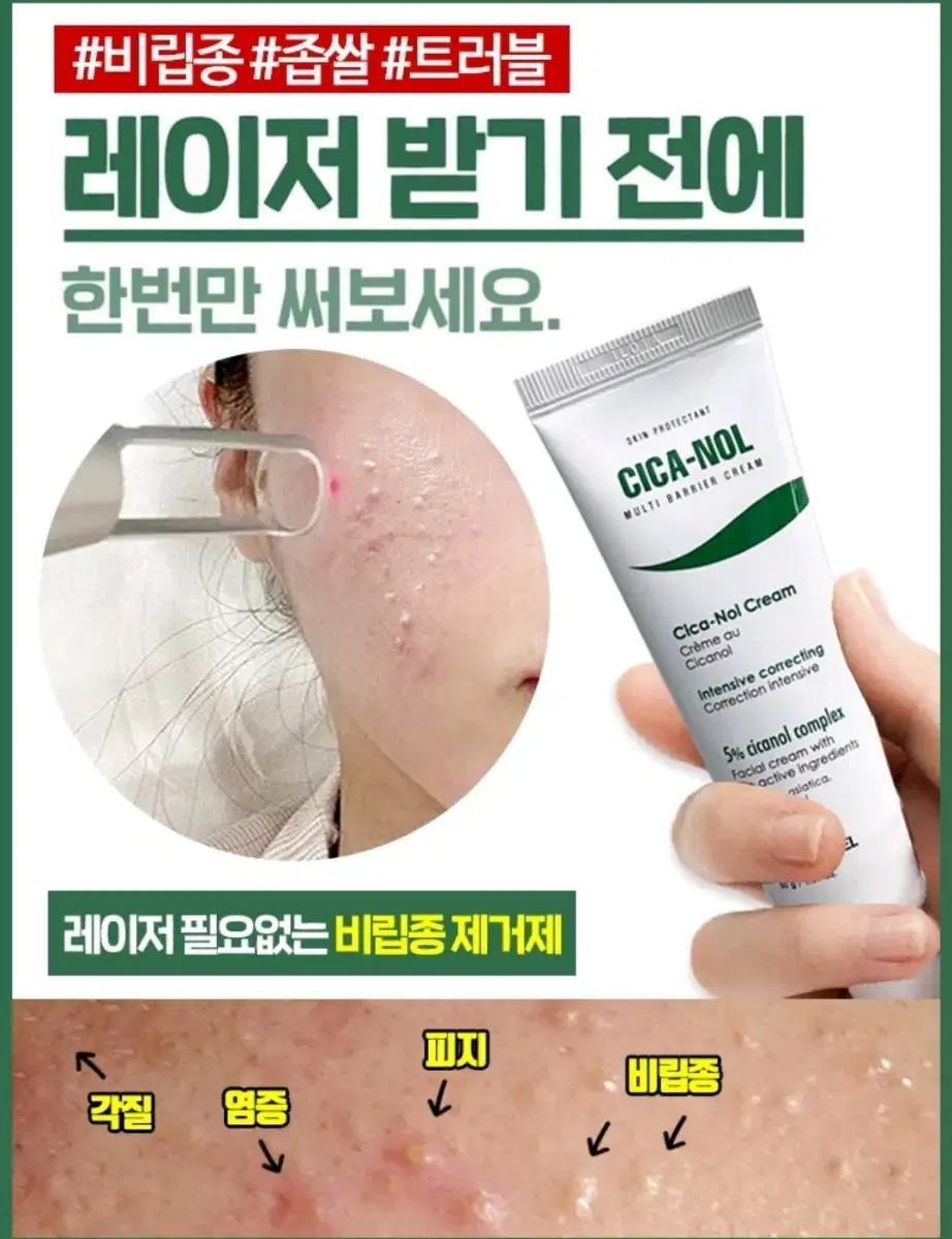 메디필 피토 시카놀 크림 비립종 좁쌀 재생 미백 주름 각질 기능성 화장품